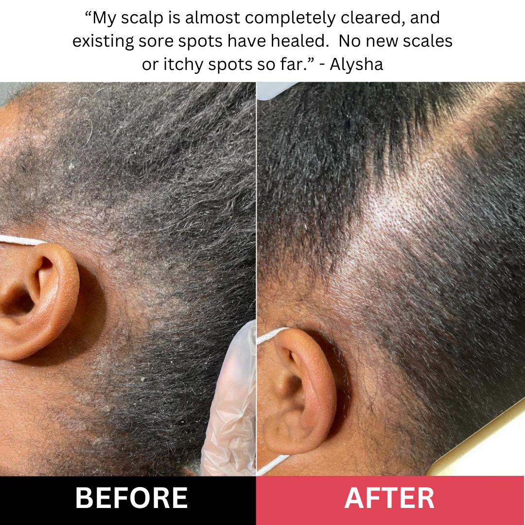 Bekynd Beauty Scalp Scrub